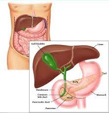 پاورپوینت کوله سیستکتومی