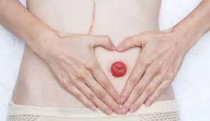 پاورپوینت مراقبت از کلستومی